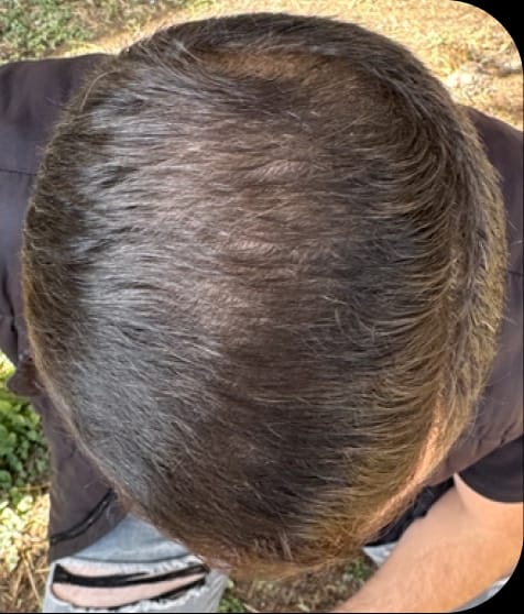 Después del tratamiento de Roberto, 26