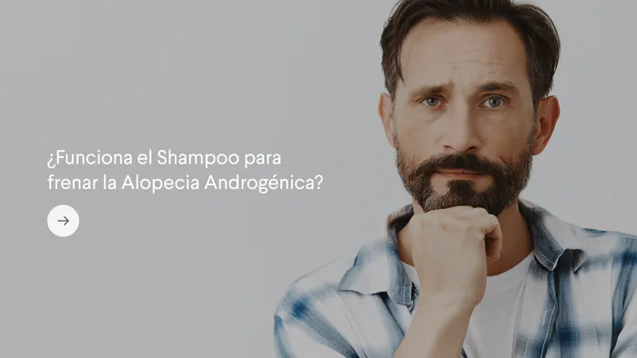 ¿Funciona el Shampoo para frenar la Alopecia Androgénica?