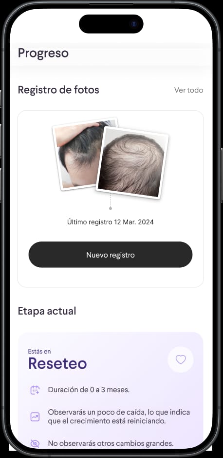 Pantalla de seguimiento de progreso del tratamiento en la app