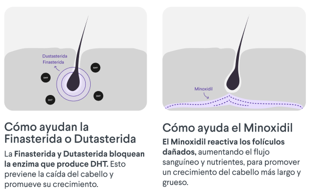 Alopecia - Dutaxidil